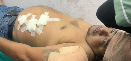 हेटौँडामा चक्कु प्रहार : आरोपीलाई पक्राउ गर्न प्रहरीको आनाकानी !